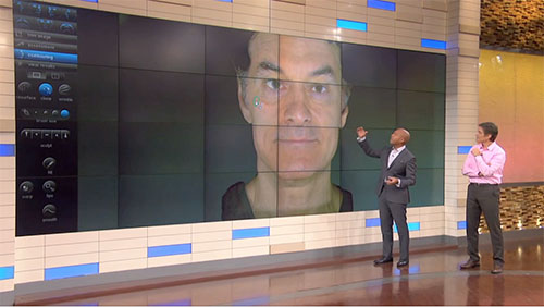VECTRA used on Dr. Oz show
